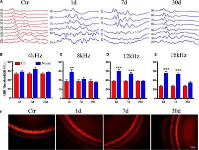 Disruption of Glutamate Release and Uptake-Related Protein Expression After Noise-Induced Synaptopathy in the Cochlea